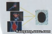 противовоспалительное действие при пояснично-крестцовом радикулите поясницы Haogang